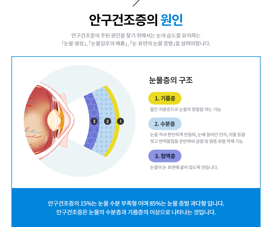 안구건조증의 원인