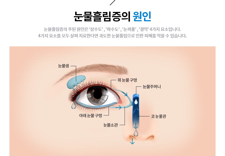 눈물흘림증의 원인