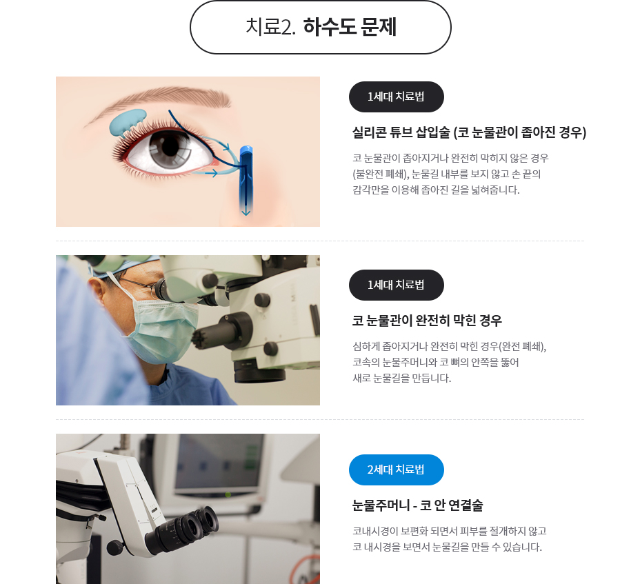 눈물흘림증 치료 방법