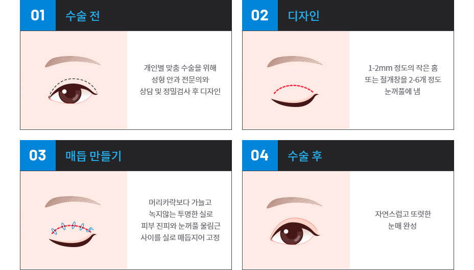 절개법 수술