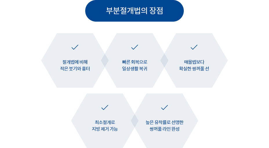 부분절개법