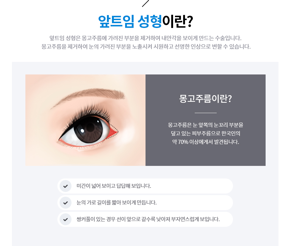 앞트임 성형이란?