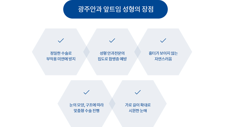 앞트임 성형 수술방법