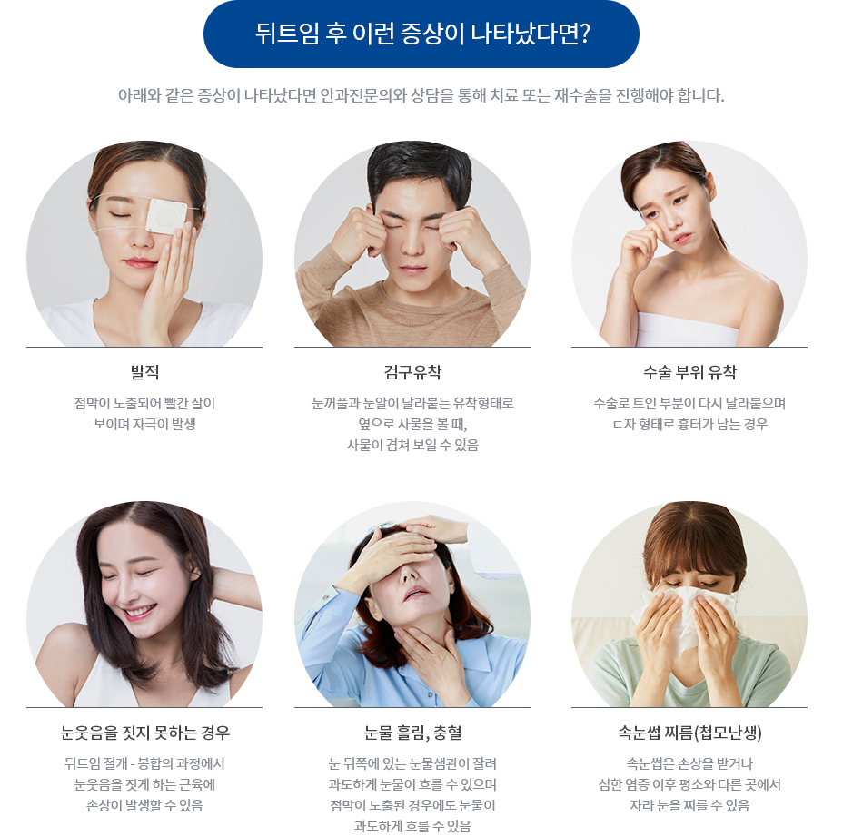 뒤트임 후 이런 증상이 나타났다면?
