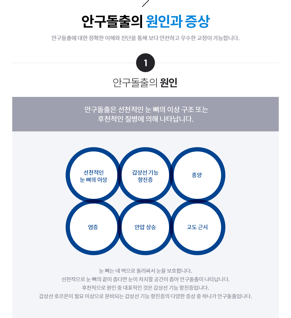 안구돌출의 원인과 증상