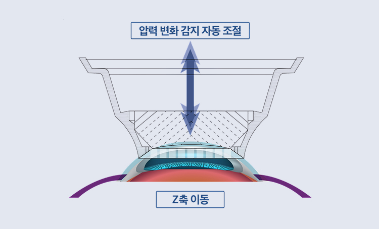 자동 압력감지 시스템 · 레이저 트래킹
